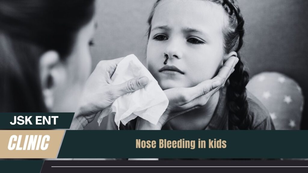 Nose Bleeding in kids
