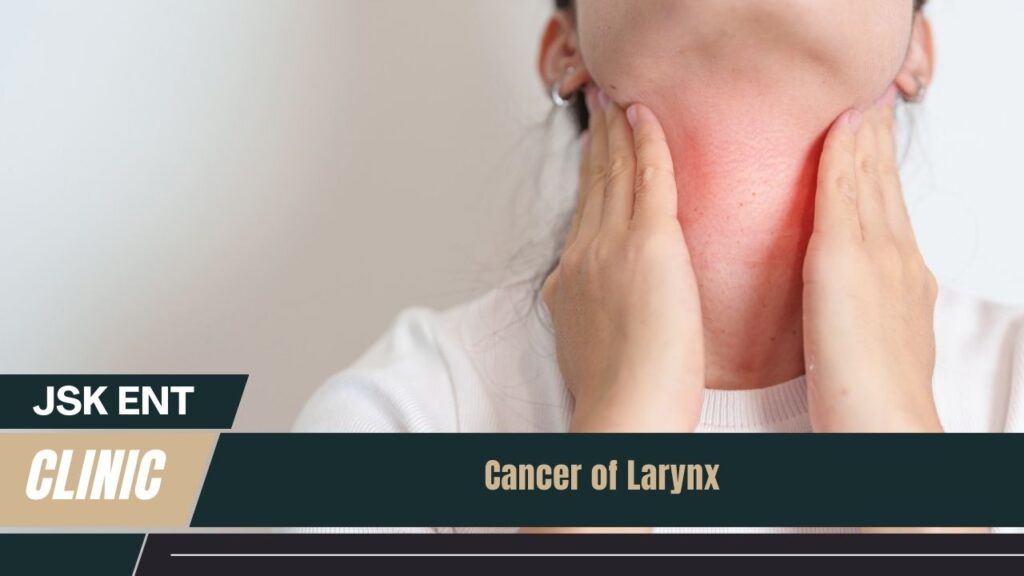 Cancer of Larynx