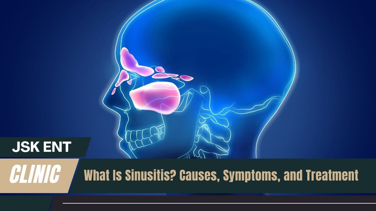 Sinusitis - islamabad